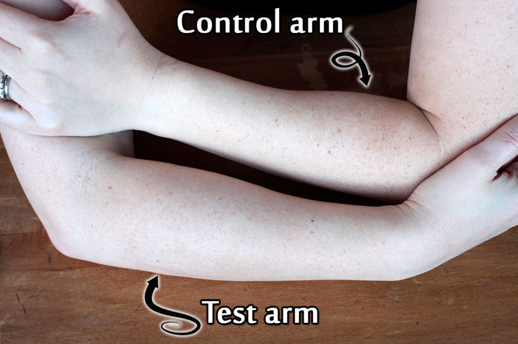My forearms compared side by side