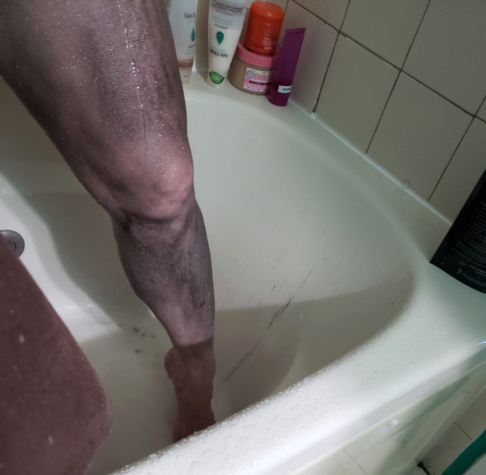 This is after I'd scrubbed it into my leg and tried to rinse it off.
